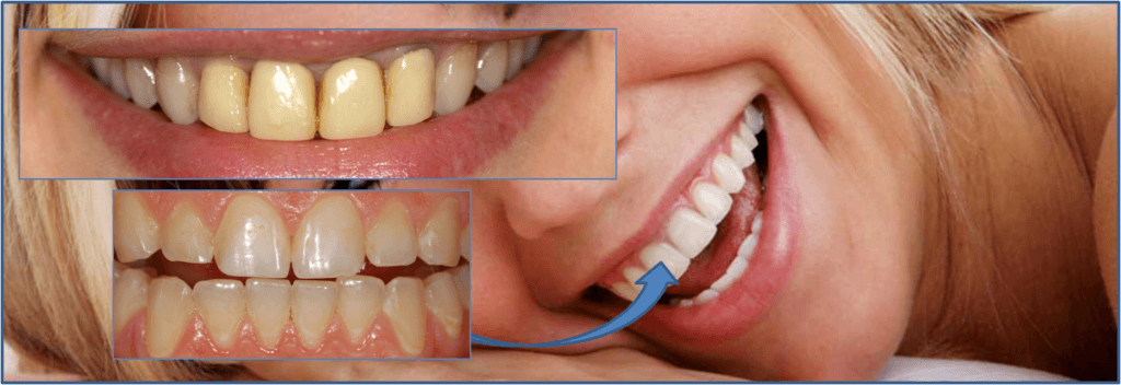 Om Dental Clinic Near Andheri For Brighter Smiles