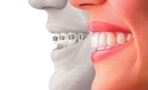 Cosmetic Dentistry (Image: Steve Alper)