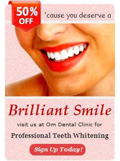 teeth-whitening-offer
